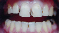 Художественная реставрация зубов, лечение парадонтоза, зубное протезирование